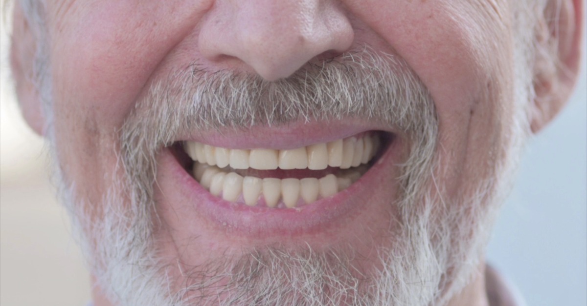 最新消息_全口植牙迷思：老人是否適合做全口植牙